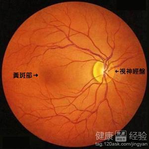 眼底黃斑變性為什麼會失明，黃斑是怎麼長大的
