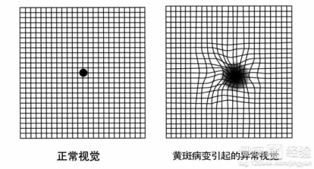 黃斑變性有什麼食療方？