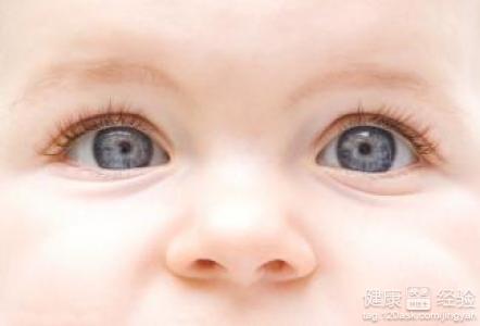 寶寶眼泛黃白異物或患結膜炎