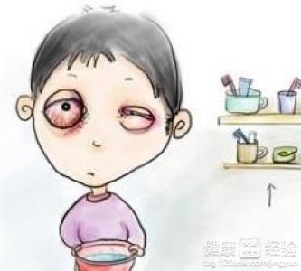 眼睛結膜炎會眼部充血嗎？