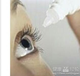 眼結膜炎的主要症狀表現為？