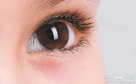 兒童結膜炎是用眼不衛生造成的嗎