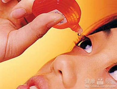 急性結膜炎用什麼眼藥水好