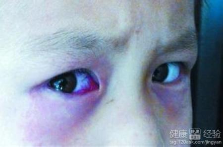 第2步