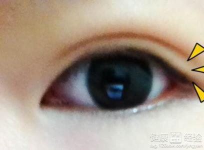 眼睛充血用什麼眼藥水