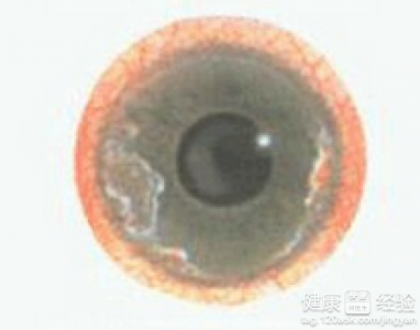 第1步