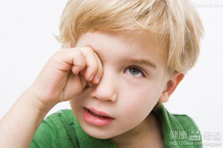 兒童麥粒腫如何治療