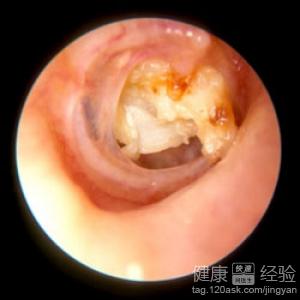 第1步