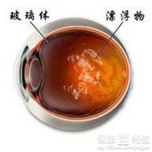 第1步