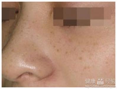 熊膽黃芩滴眼液和熊膽眼藥水有什麼區別