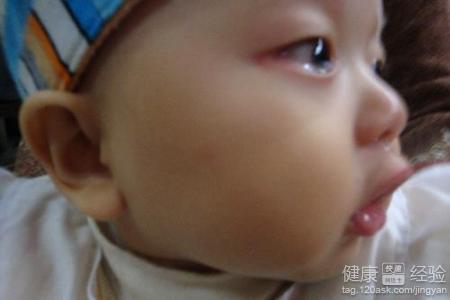 2個月嬰兒左眼流淚該怎麼解決