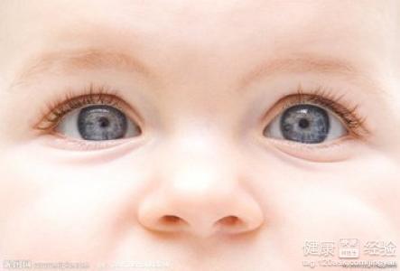 寶寶眼睛見風會流淚能吊水治療嗎