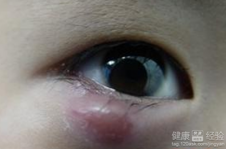 第2步
