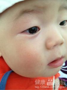 嬰兒一只眼睛流淚能用滴眼液嗎