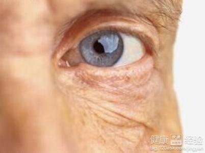 老年人常流淚下眼臉腫是什麼引起的