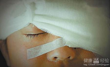 小角膜怎麼辦