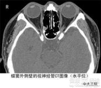 急性淚囊炎怎麼辦