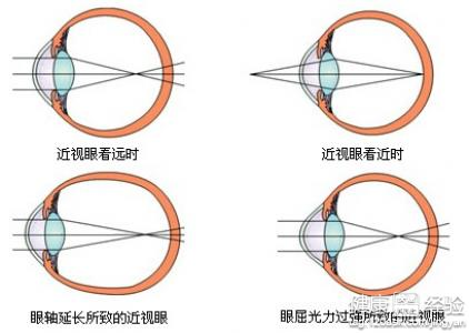 第3步