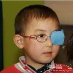 第2步