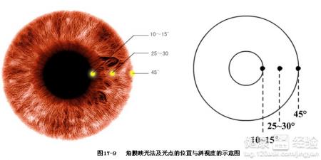 第1步