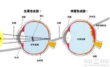 孩子弱視吃什麼