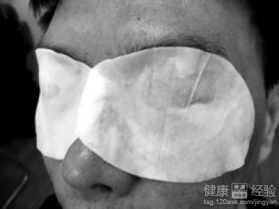 玻璃體混濁根治嗎