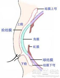 小孩弱視怎樣治療效果好