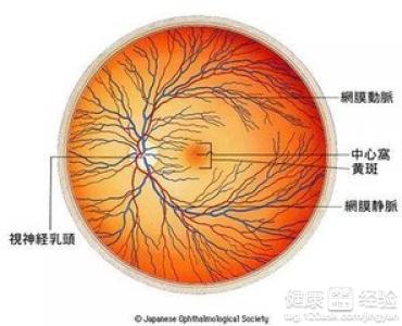 先天性弱視帶矯正器有改善的幫助嗎