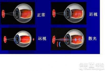 小兒近視遠視散光弱視如何治療