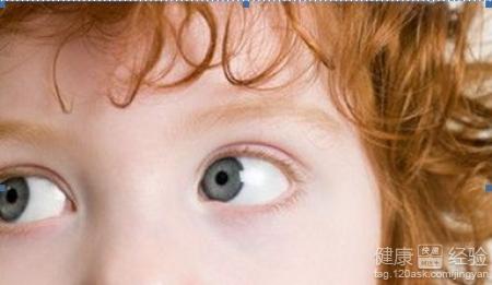 小孩眼底視神經萎縮眼球震顫散光弱視怎麼辦