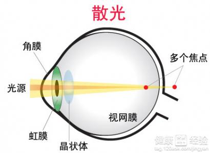 眼睛散光怎麼矯正