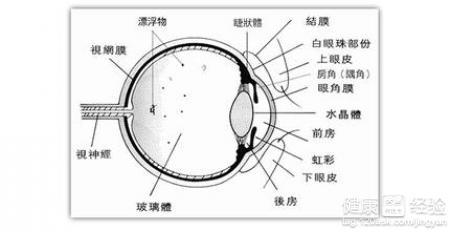 如何區分生理性飛蚊症和病理性飛蚊症