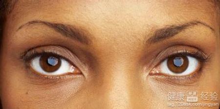 眼疲勞會影響什麼