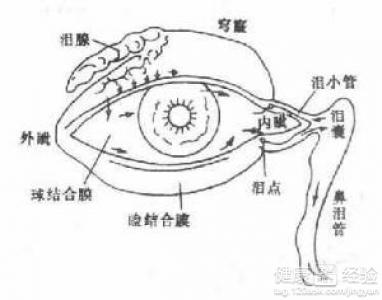 眼疲勞能引起結膜炎嗎