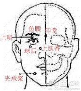 第2步