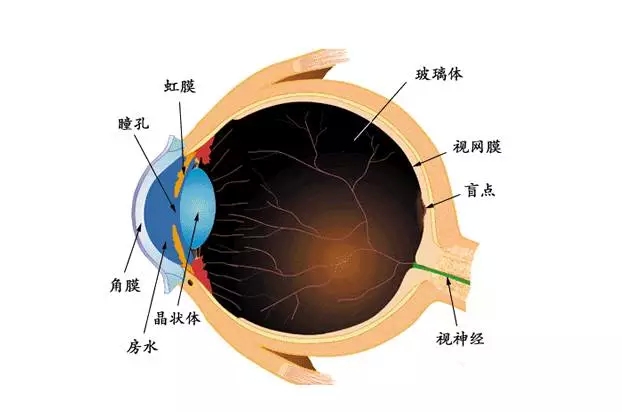 麻痺性斜視有什麼症狀？