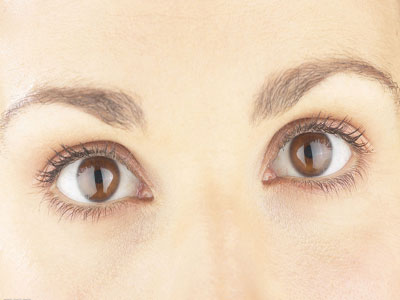 伴有虹膜睫狀體炎的繼發性青光眼的臨床表現