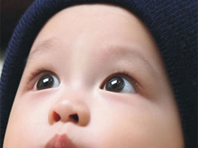 寶寶眼屎多可能是患淚囊炎