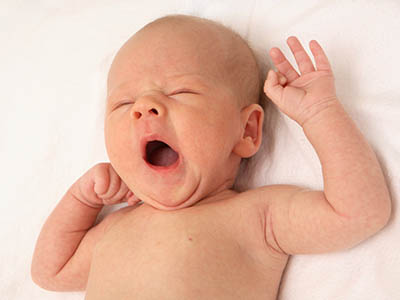新生兒淚囊炎的症狀有什麼