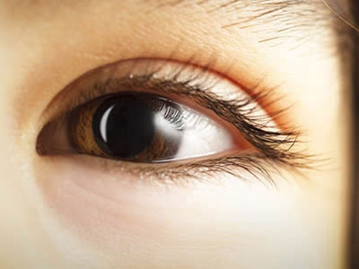 閉角型青光眼的表現及特征