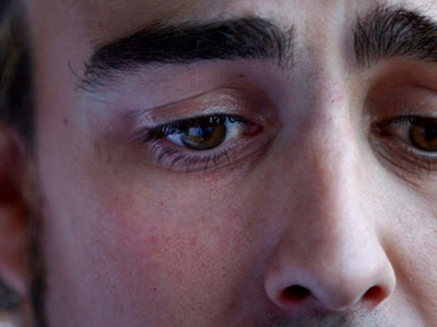 眼睛發紅是過敏 眼睛告訴你的九種疾病