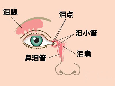 嬰兒一只眼睛流淚 可能得了鼻淚管堵塞