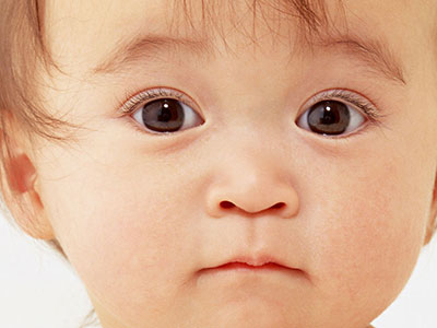 嬰幼兒的眼睛異常的表現