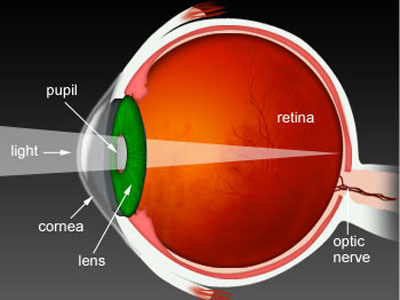 青光眼症狀及時了解 有效預防是關鍵