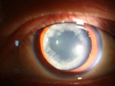 從眼睛的虹膜看個人的健康