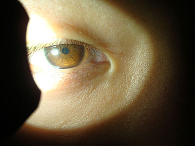 小心10大眼睛症狀預示患大病