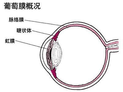 眼紅眼腫可能是葡萄膜炎的征兆