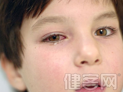 眼睛浮腫疼痛 小心是眼眶腫瘤