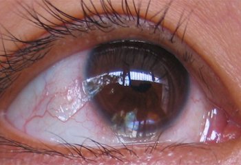 10個關於眼健康的傳言，是真的嗎？