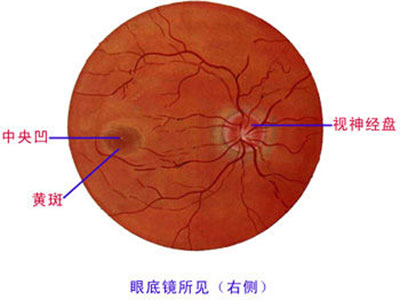 眼底檢查能發現動脈硬化